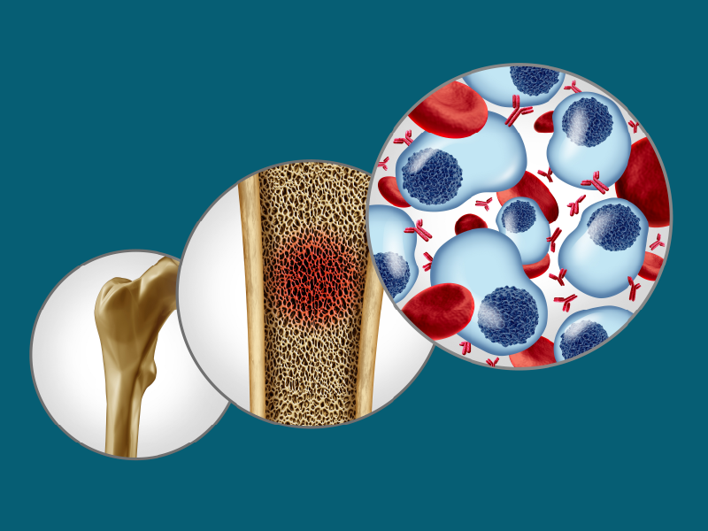 ProCE Banner Activity