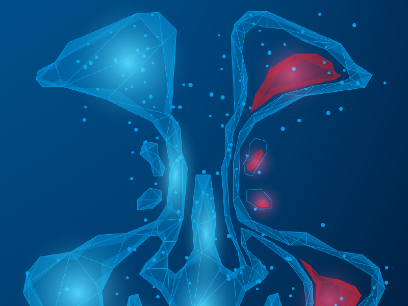 ProCE Banner Activity