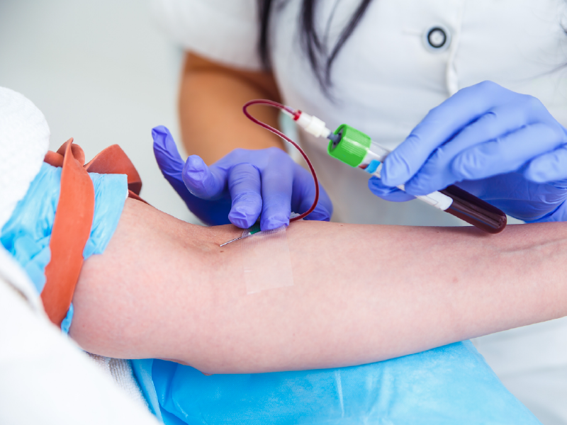 ProCE Banner Activity