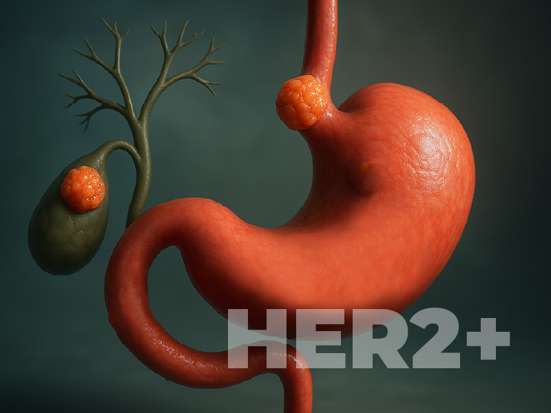 Management of Progressive BTC