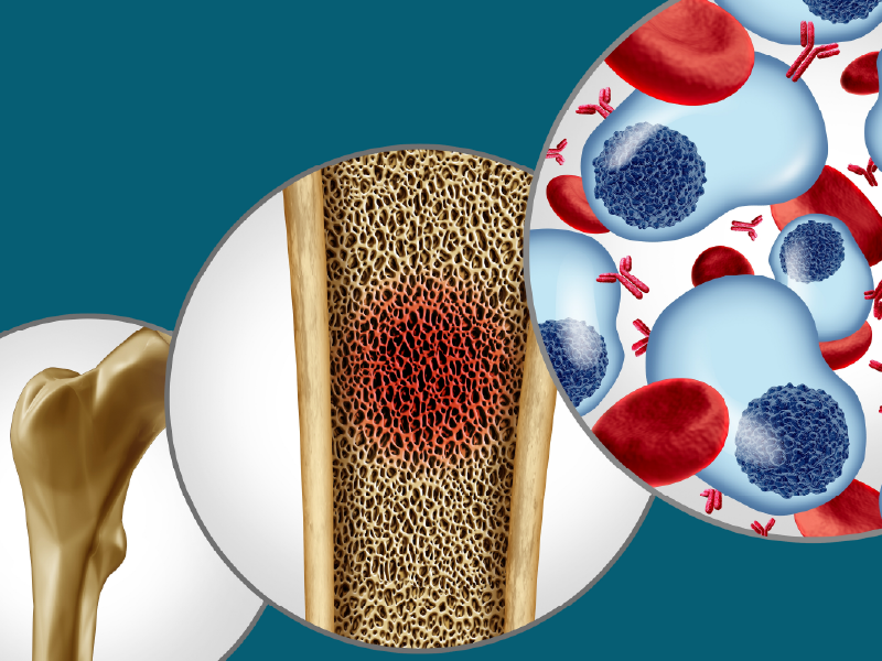 ProCE Banner Activity