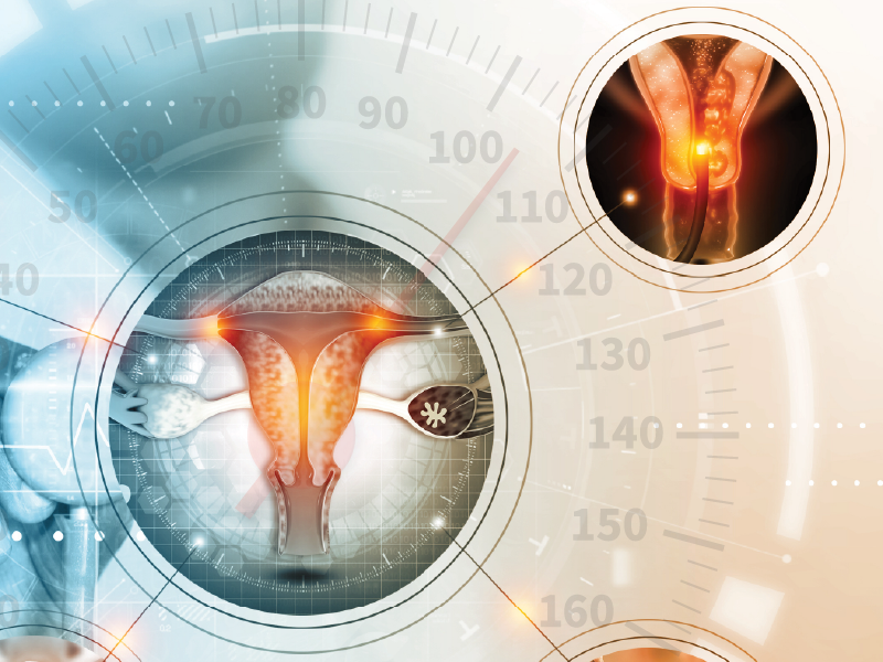 ProCE Banner Activity