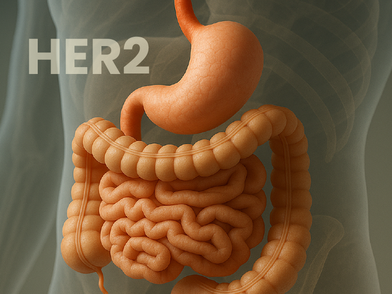 HER2 in GI Cancers