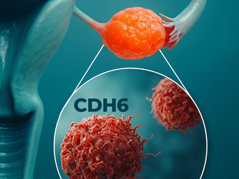 CDH6 ADCs Ovarian Cancer