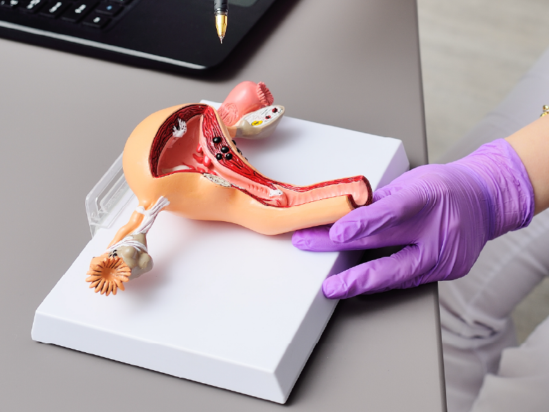 Avutometinib Defactinib for KRASm LGSOC