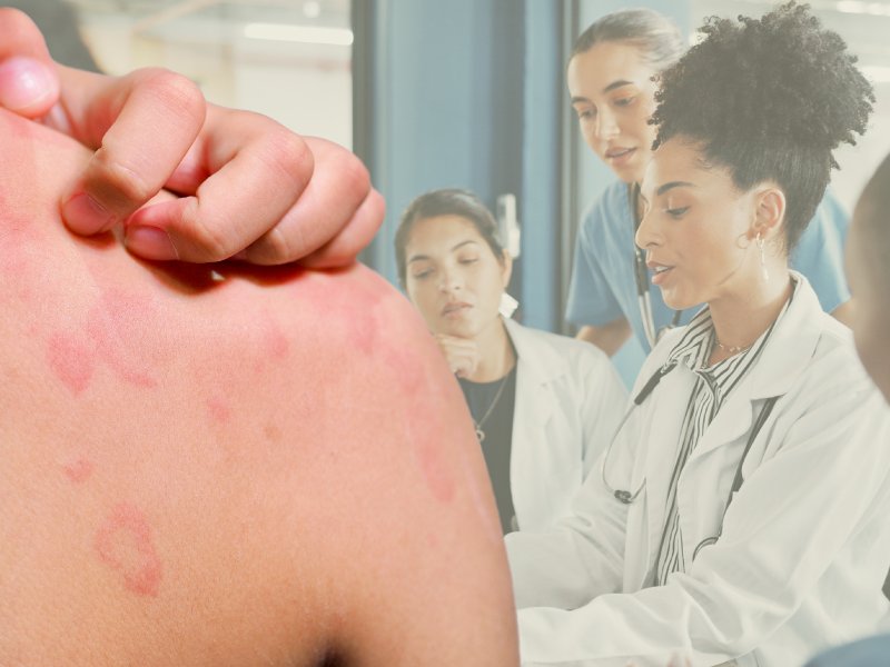 ProCE Banner Activity