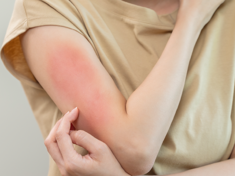 ProCE Banner Activity