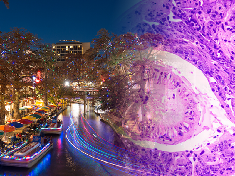 ProCE Banner Activity