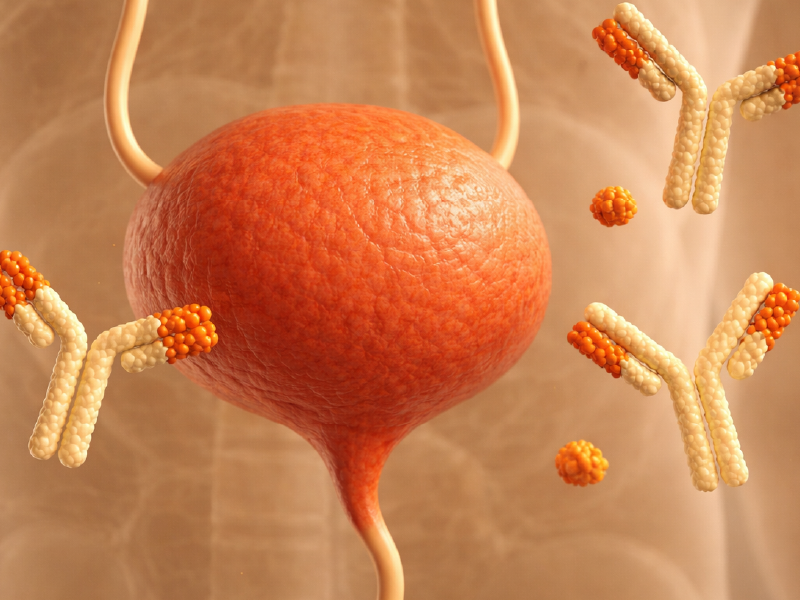 HER2 ADCs in Advanced Bladder Cancer