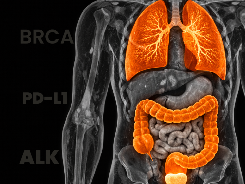 Case Challenge: Prostate Cancer