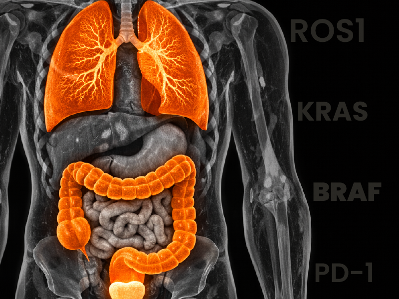 Case Challenge: Colorectal Cancer