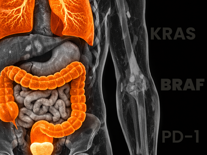 ProCE Banner Activity