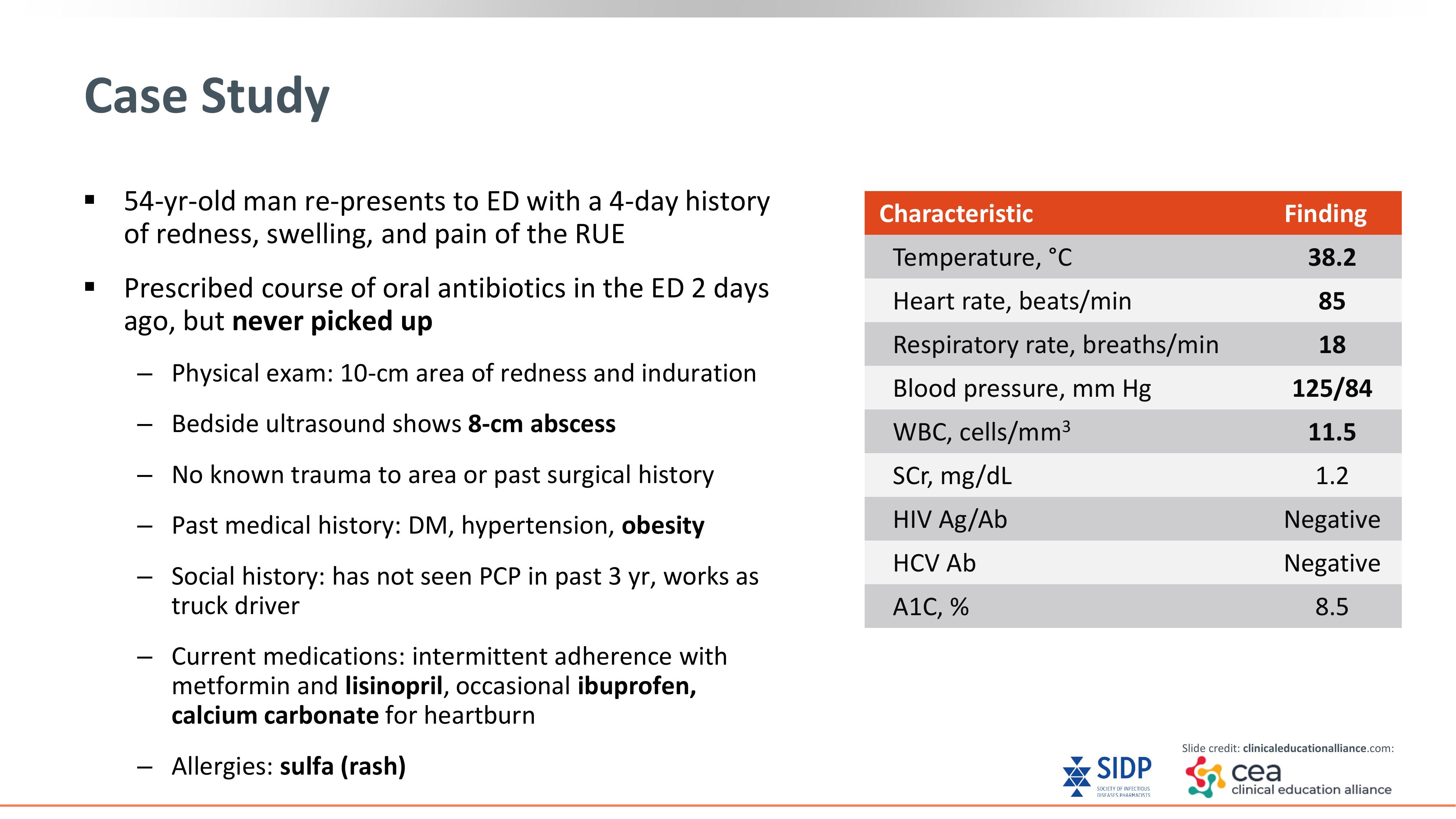 健康・医学 Common Diseases Up to date Multisystem Inflammatory Syndrome in Children in New York